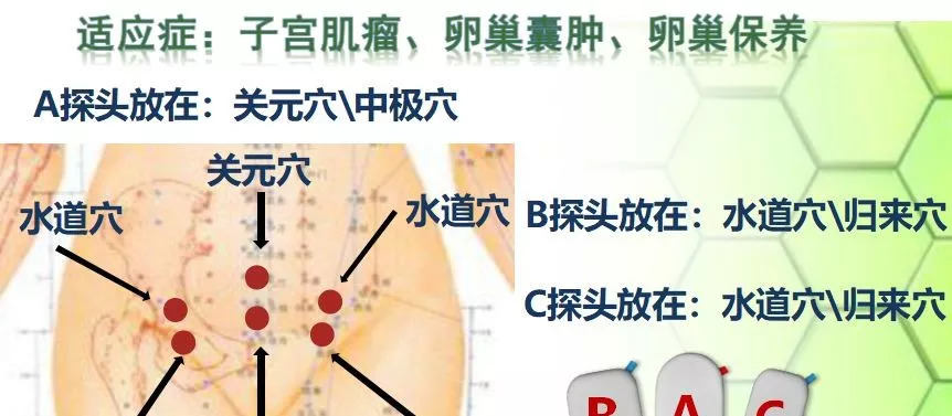 类风湿最新治疗方法，突破与创新的治疗途径